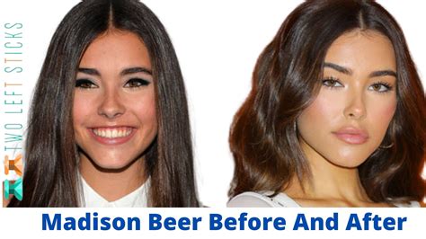 madison beer before plastic|The Truth About Madison Beers Plastic Surgery Rumors